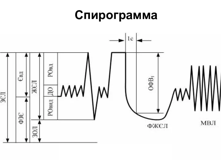 Спирограмма