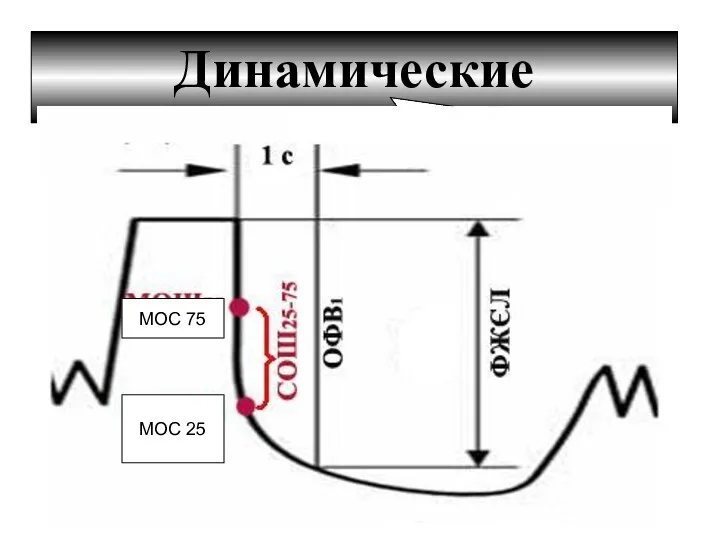 Динамические показатели МОС 75 МОС 25