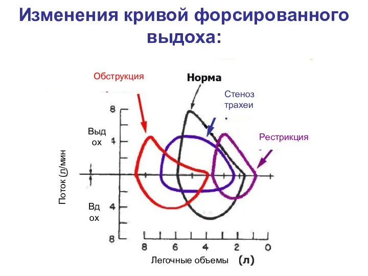 Изменения кривой форсированного выдоха: Обструкция Рестрикция Стеноз трахеи ) Поток (л/мин Выдох Вдох Легочные объемы