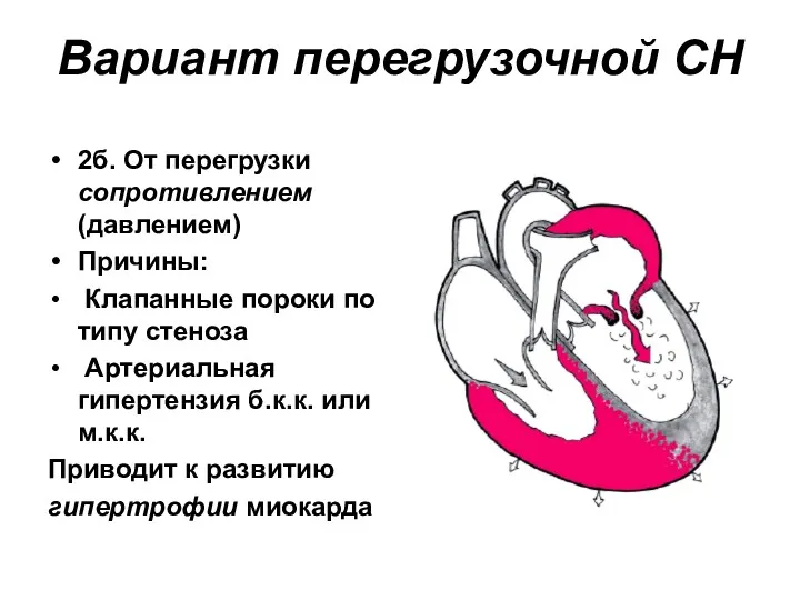 Вариант перегрузочной СН 2б. От перегрузки сопротивлением (давлением) Причины: Клапанные