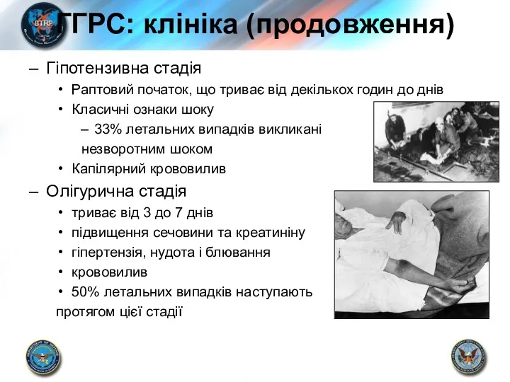 ГГРС: клініка (продовження) Гіпотензивна стадія Раптовий початок, що триває від