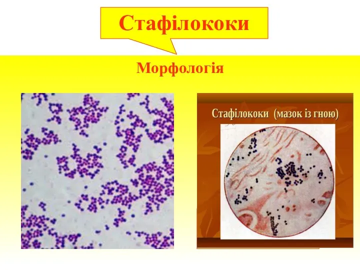 Морфологія Стафілокок (мазок з чистої культури) Стафілококи