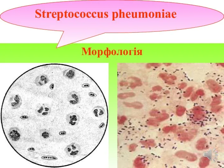 Морфологія Streptococcus рheumoniae