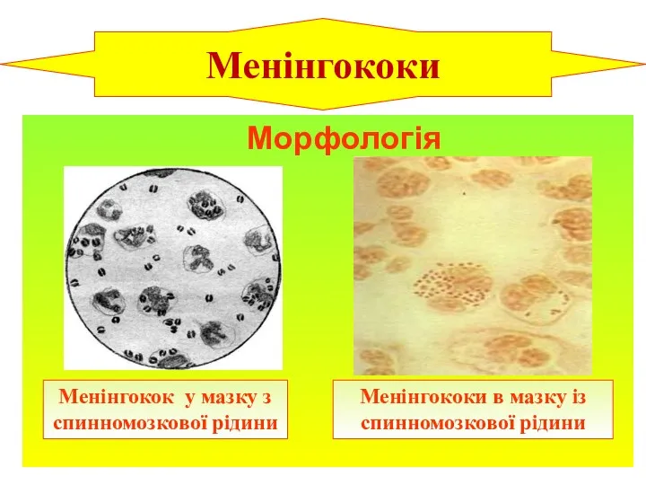Морфологія Менінгокок у мазку з спинномозкової рідини Менінгококи Менінгококи в мазку із спинномозкової рідини
