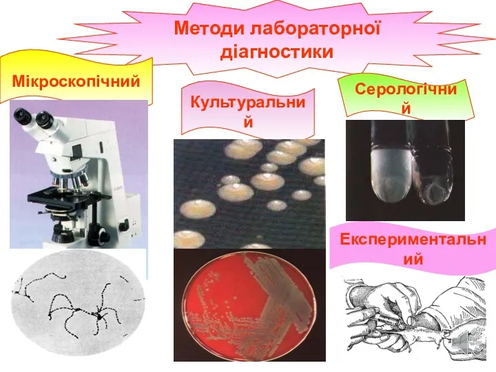 Методи лабораторної діагностики Мікроскопічний Культуральний Серологічний Експериментальний