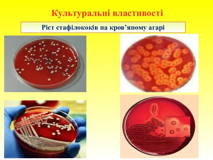 Ріст стафілококів на кров’яному агарі Культуральні властивості