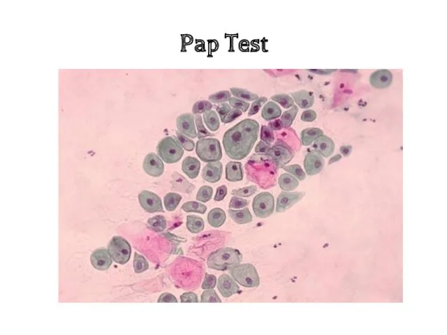 Pap Test