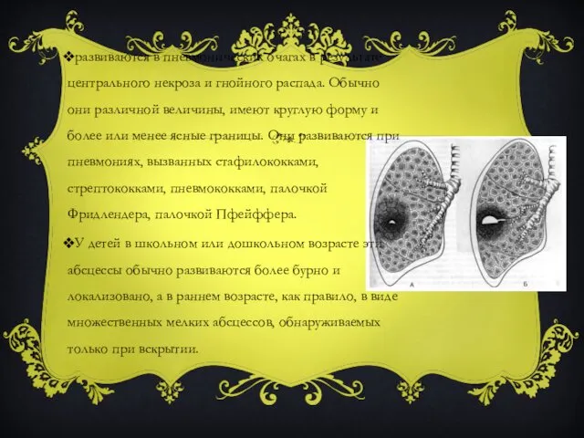 развиваются в пневмонических очагах в результате центрального некроза и гнойного