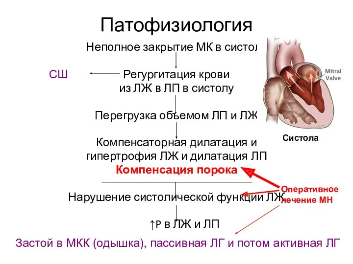 Патофизиология Неполное закрытие МК в систолу Регургитация крови из ЛЖ