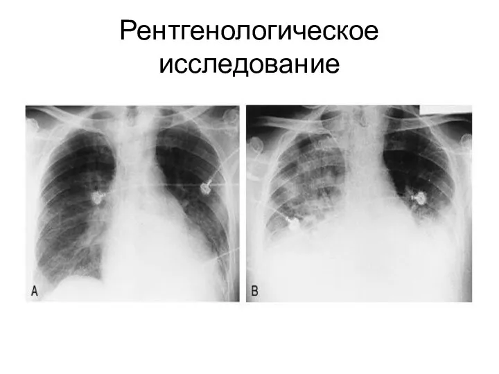 Рентгенологическое исследование