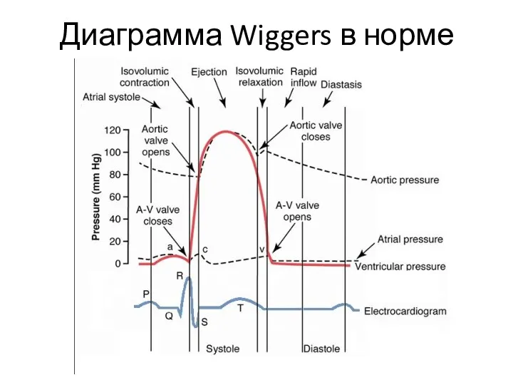 Диаграмма Wiggers в норме