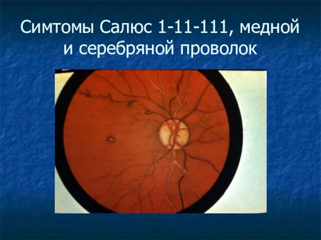 Симтомы Салюс 1-11-111, медной и серебряной проволок