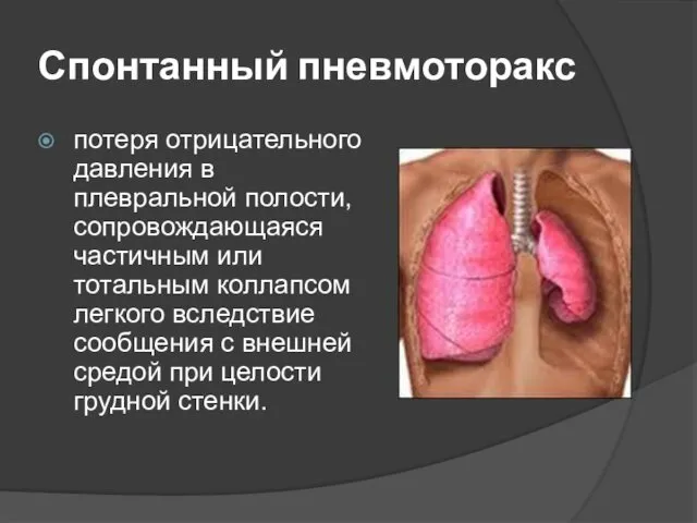 Спонтанный пневмоторакс потеря отрицательного давления в плевральной полости, сопровождающаяся частичным