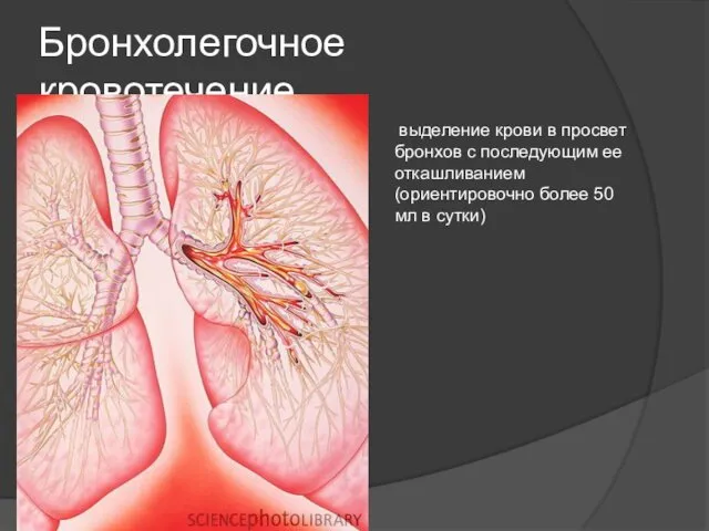 Бронхолегочное кровотечение выделение крови в просвет бронхов с последующим ее