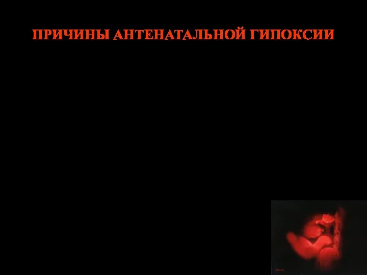 ПРИЧИНЫ АНТЕНАТАЛЬНОЙ ГИПОКСИИ Во время беременности: ПОНРП, предлежание плаценты, разрыв