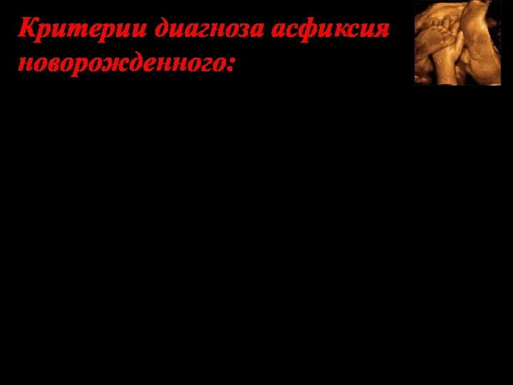 Критерии диагноза асфиксия новорожденного: 1) Тромбоцитопения – (170 тыс. и