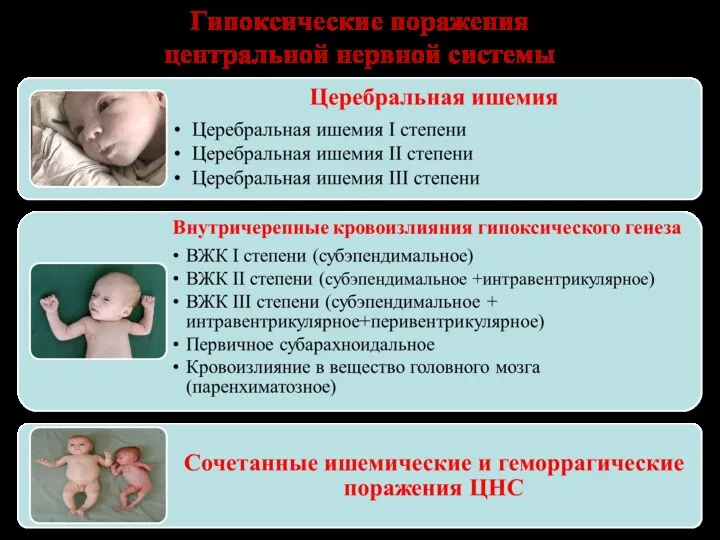 Гипоксические поражения центральной нервной системы