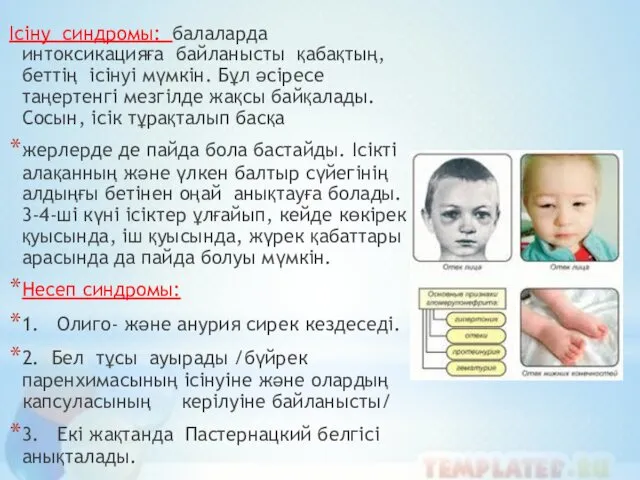 Ісіну синдромы: балаларда интоксикацияға байланысты қабақтың, беттің ісінуі мүмкін. Бұл