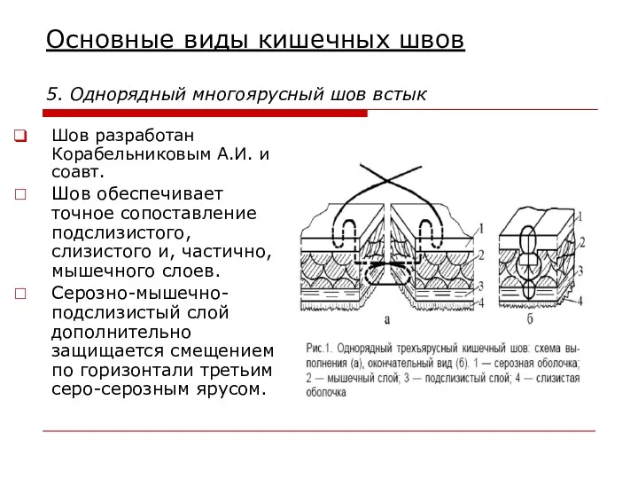 Основные виды кишечных швов 5. Однорядный многоярусный шов встык Шов разработан Корабельниковым А.И.