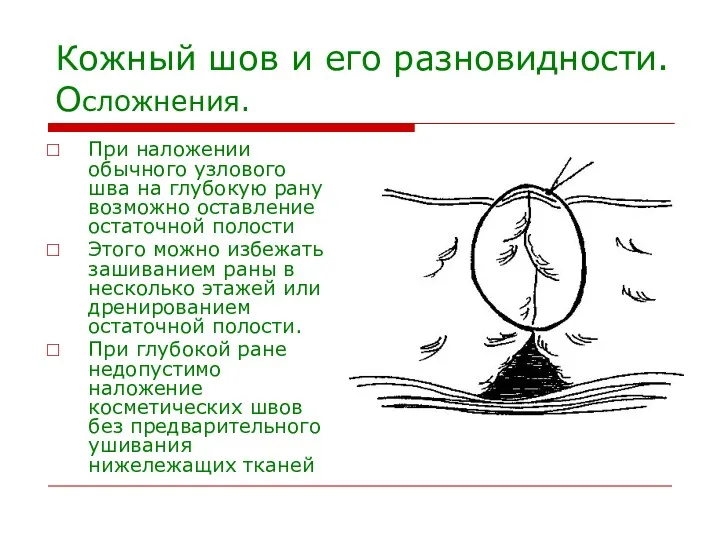 Кожный шов и его разновидности. Осложнения. При наложении обычного узлового шва на глубокую