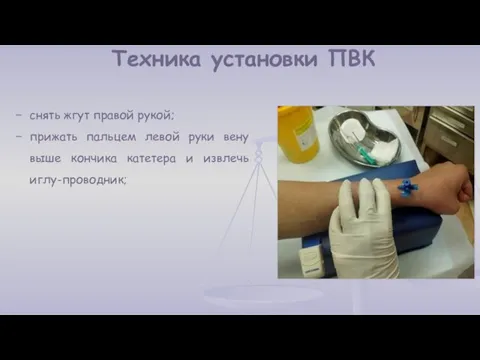 снять жгут правой рукой; прижать пальцем левой руки вену выше кончика катетера и