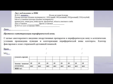 Техника установки ПВК при высоком риске случайного удаления, ПВК дополнительно