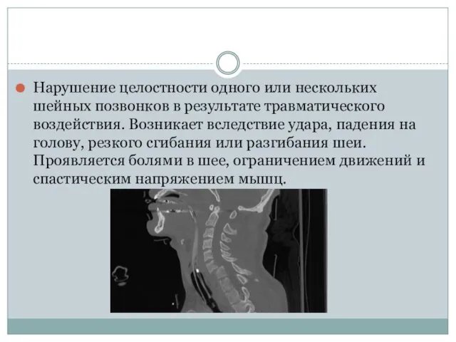 Нарушение целостности одного или нескольких шейных позвонков в результате травматического