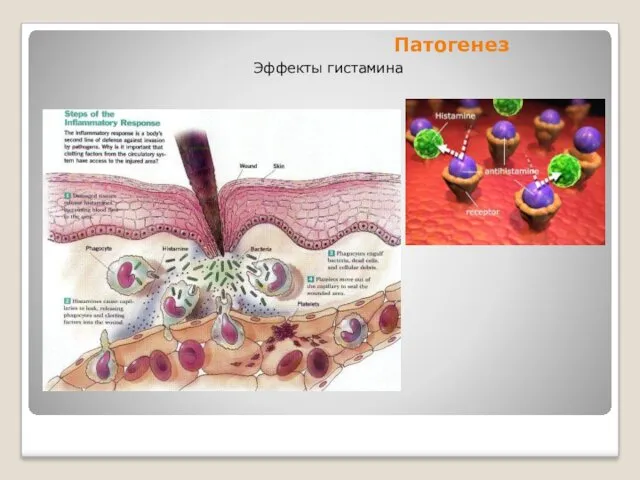Патогенез Эффекты гистамина