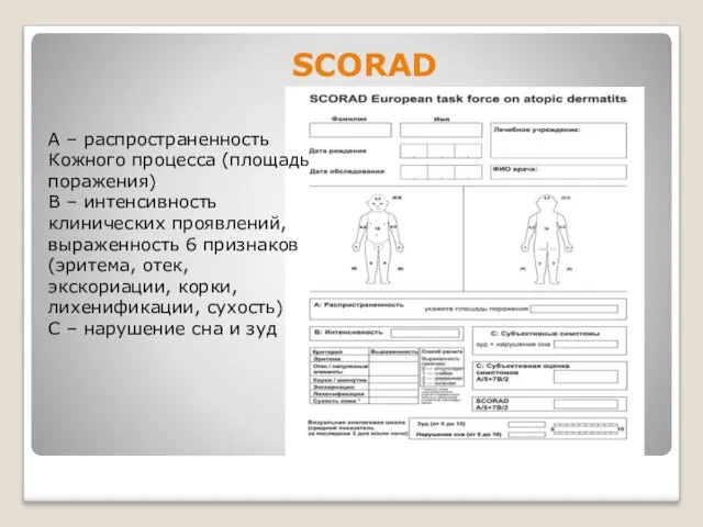 SCORAD А – распространенность Кожного процесса (площадь поражения) В –