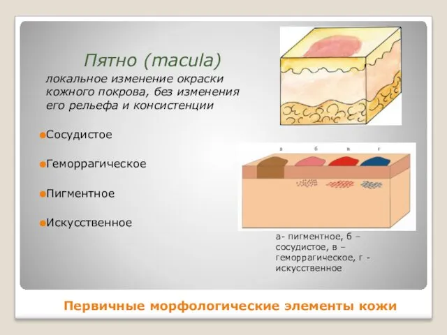 Первичные морфологические элементы кожи а- пигментное, б – сосудистое, в