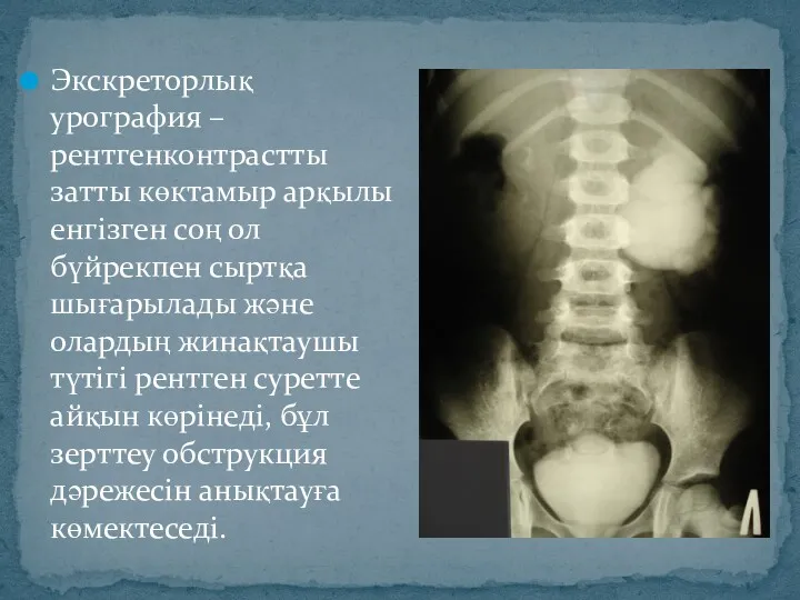 Экскреторлық урография – рентгенконтрастты затты көктамыр арқылы енгізген соң ол