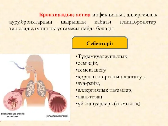 Бронхиалдық астма-инфекциялық аллергиялық ауру,бронхтардың шырышты қабаты ісініп,бронхтар тарылады,тұншығу ұстамасы пайда