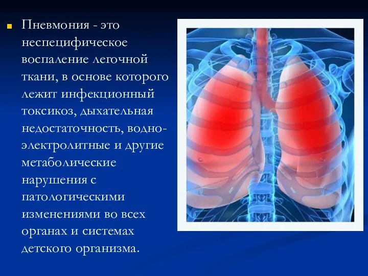Пневмония - это неспецифическое воспаление легочной ткани, в основе которого лежит инфекционный токсикоз,