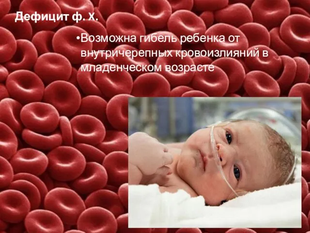 Дефицит ф. X. Возможна гибель ребенка от внутричерепных кровоизлияний в младенческом возрасте