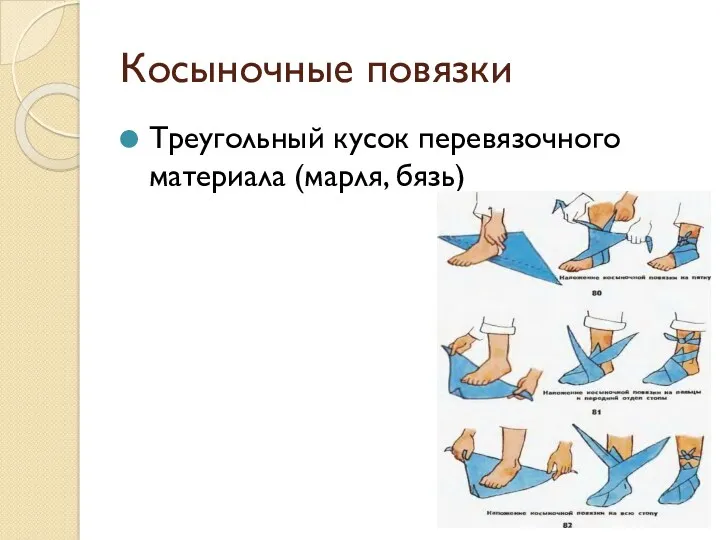 Косыночные повязки Треугольный кусок перевязочного материала (марля, бязь)