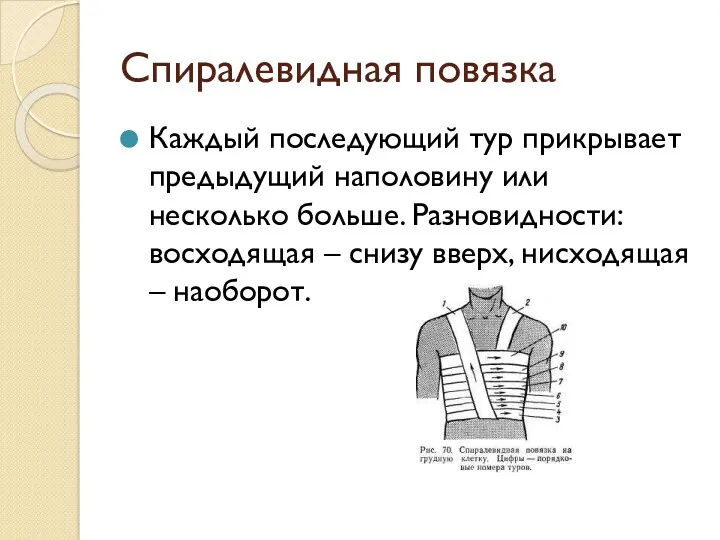 Спиралевидная повязка Каждый последующий тур прикрывает предыдущий наполовину или несколько