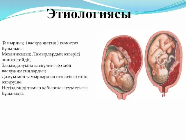 Этиологиясы Тамырлық (васкулопатия ) гемостаз бұзылысы Механикалық .Тамырлардың өзгерісі эндотелийдің