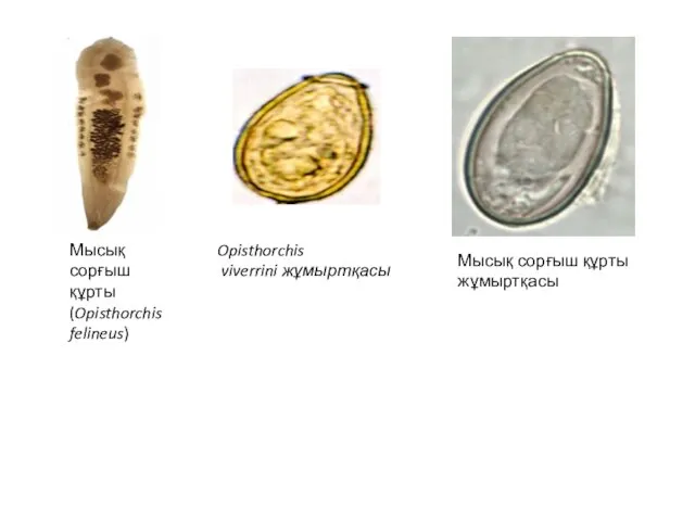 Мысық сорғыш құрты (Opisthorchis felineus) Мысық сорғыш құрты жұмыртқасы Opisthorchis viverrini жұмыртқасы