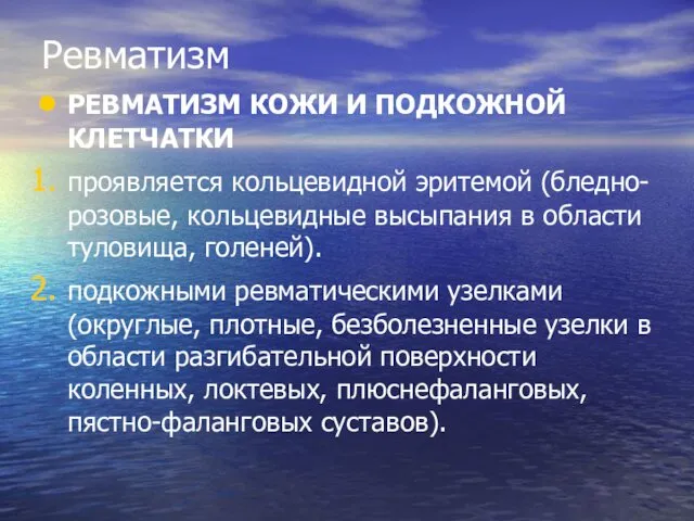 Ревматизм РЕВМАТИЗМ КОЖИ И ПОДКОЖНОЙ КЛЕТЧАТКИ проявляется кольцевидной эритемой (бледно-розовые,