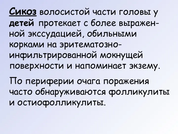 Сикоз волосистой части головы у детей протекает с более выражен-ной