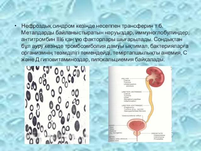 Нефроздық синдром кезінде несеппен трансферин т.б. Металдарды байланыстыратын нәруыздар, иммуноглобулиндер,
