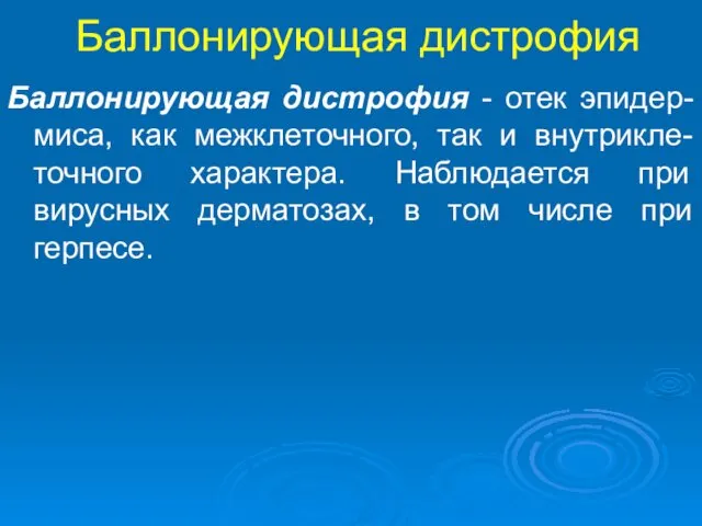 Баллонирующая дистрофия Баллонирующая дистрофия - отек эпидер-миса, как межклеточного, так