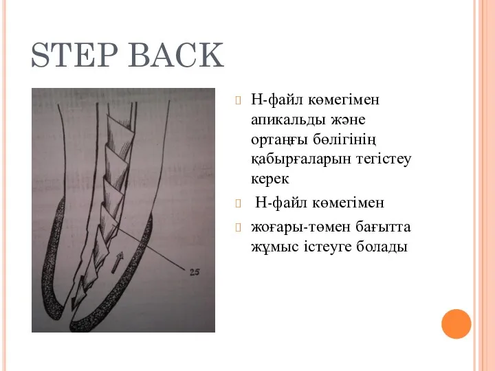 STEP BACK Н-файл көмегімен апикальды және ортаңғы бөлігінің қабырғаларын тегістеу