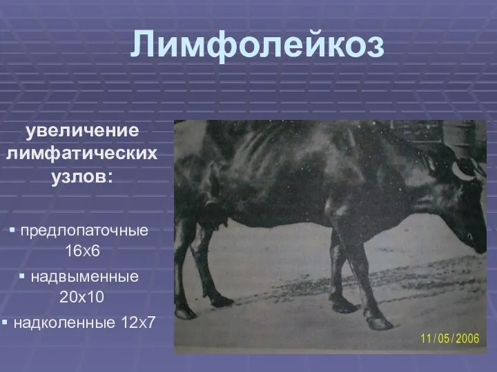 Лимфолейкоз увеличение лимфатических узлов: предлопаточные 16Х6 надвыменные 20х10 надколенные 12Х7