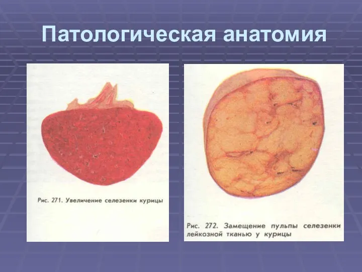 Патологическая анатомия