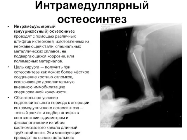 Интрамедуллярный остеосинтез Интрамедуллярный (внутрикостный) остеосинтез проводят с помощью различных штифтов