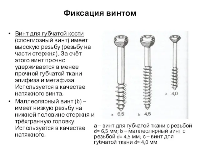 Фиксация винтом Винт для губчатой кости (спонгиозный винт) имеет высокую