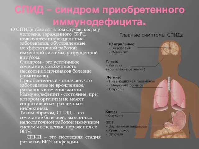 СПИД – синдром приобретенного иммунодефицита. О СПИДе говорят в том