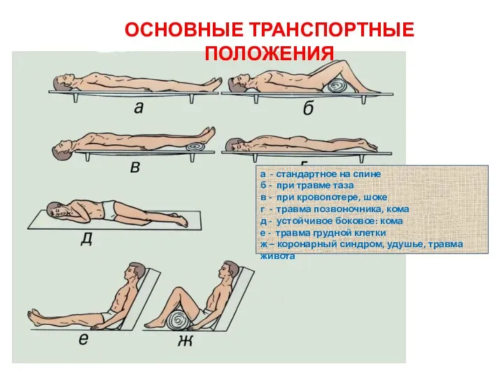 ОСНОВНЫЕ ТРАНСПОРТНЫЕ ПОЛОЖЕНИЯ а - стандартное на спине б -