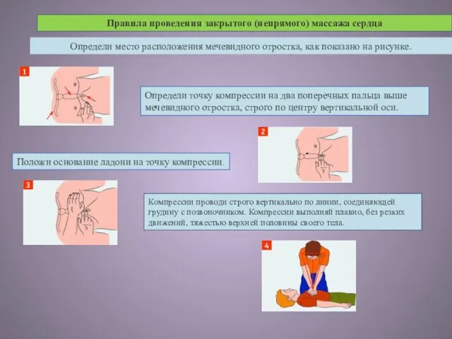 Правила проведения закрытого (непрямого) массажа сердца Определи место расположения мечевидного